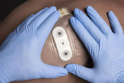 Bolin™ Chest Seal