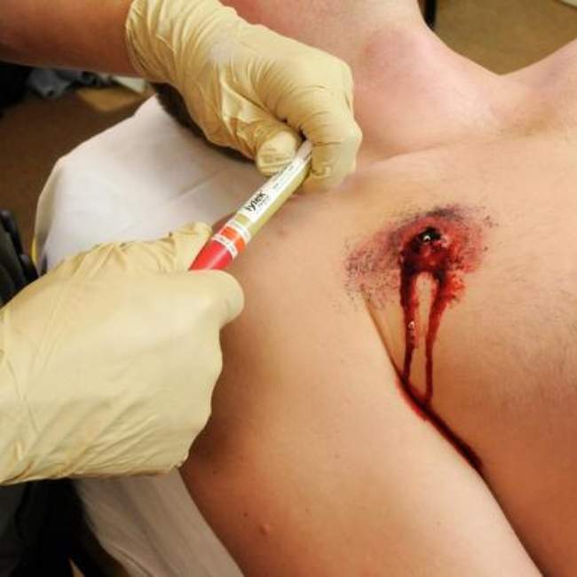 TPAK Chest Decompression Needle